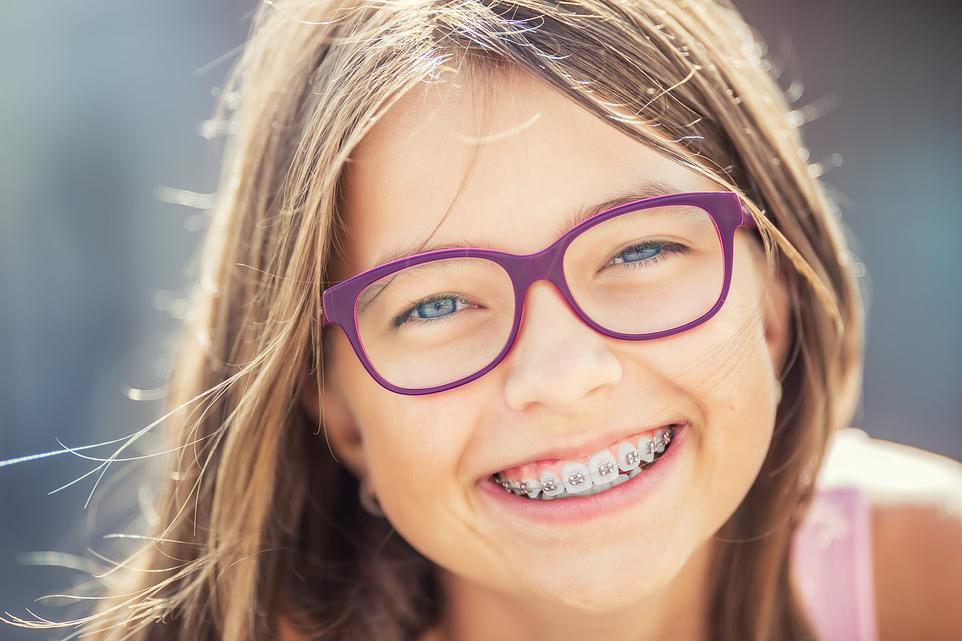 Dental Braces
