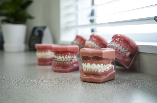 Dental models displaying teeth and orthodontic brackets arranged on clinic counter with window background.