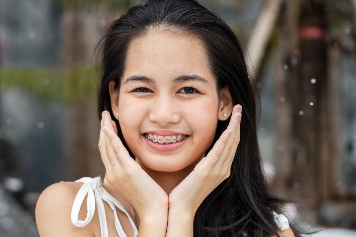 Featured image for “Best Age to Get Braces for Straight, Healthy Teeth”