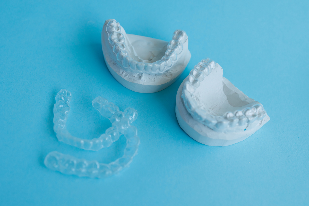Featured image for “Thinking About Invisalign for an Overbite? Here’s What to Know”